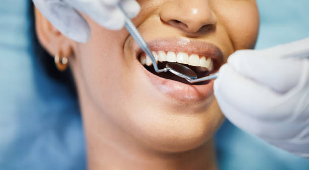 Best Emergency Dental Care for Broken or Chipped Teeth in Leonard, TX